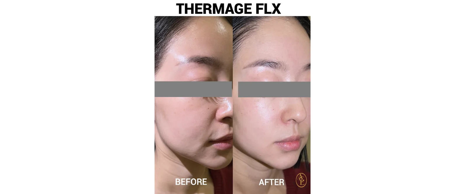 Zero Age MedSpa